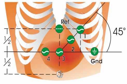 Fig. 1.